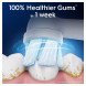 Сменные насадки для зубной щетки Oral-B iO Gentle Care (4 шт.) в Нижневартовске